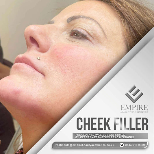 Discounted cheek filler appointment as a model in Chester