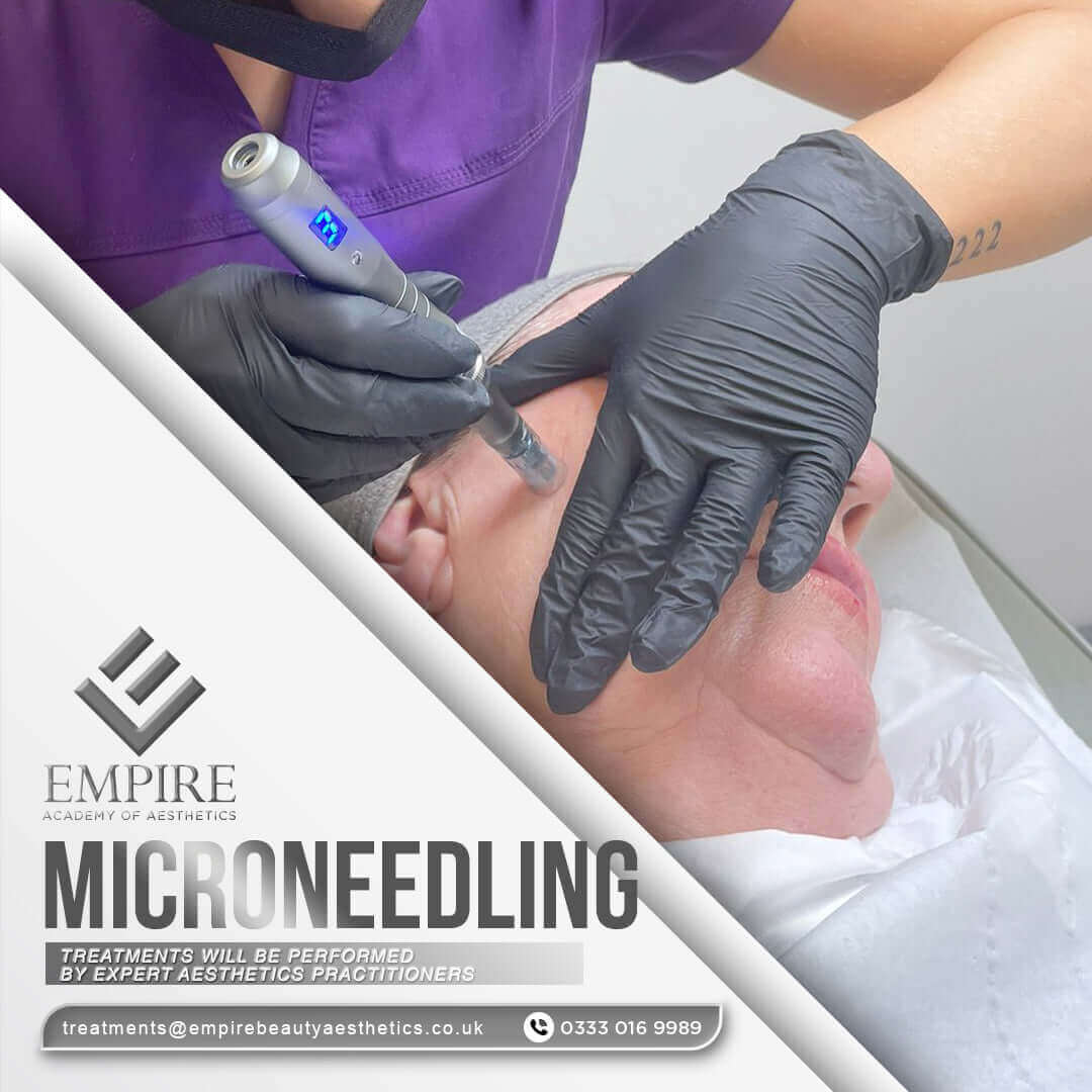 Discounted Microneedling appointment as a model in our Chester clinic