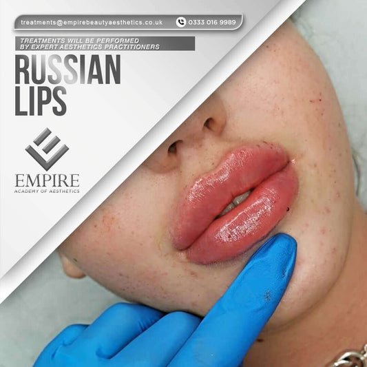 Russian Lips appointment as a model in our Chester clinic