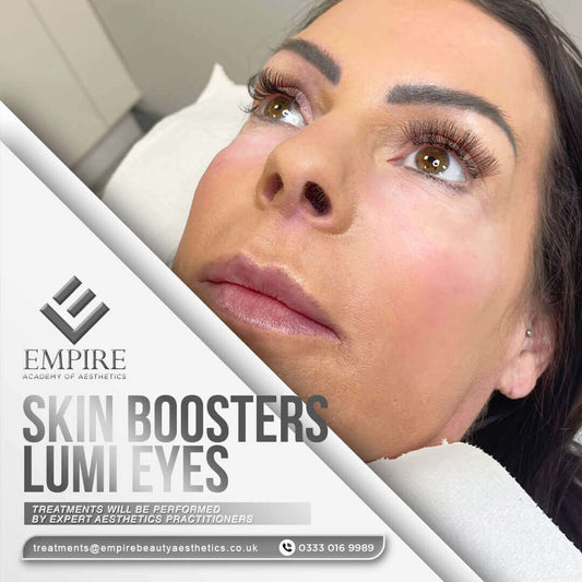 Lumi Eyes appointment as a model in our Chester clinic