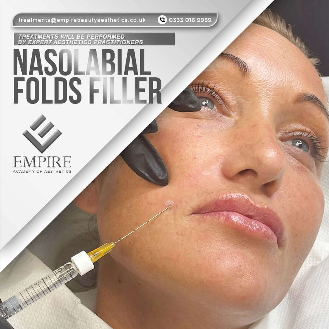 Nasolabial Folds (Nose to Smile Lines) Filler treatment as a model in our Warrington clinic