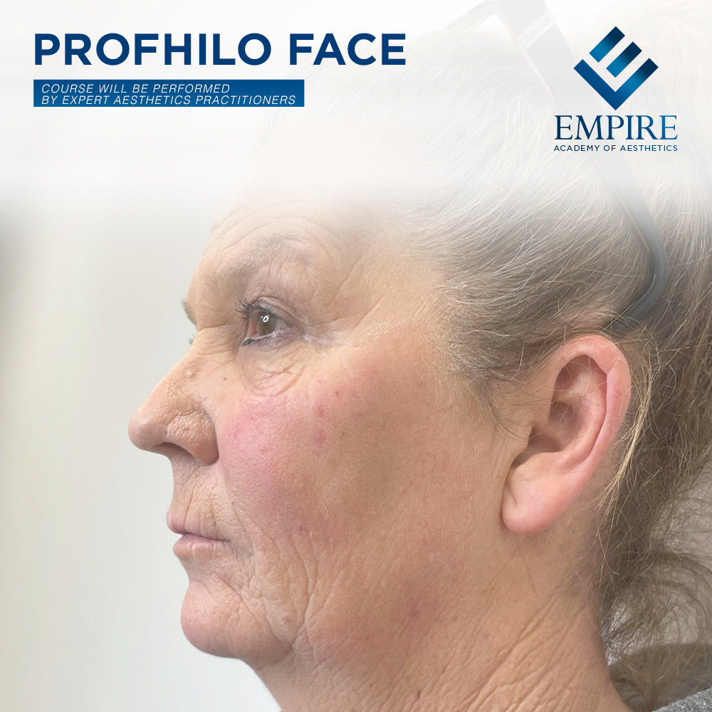 Profhilo Face Course at Empire Academy of Aesthetics