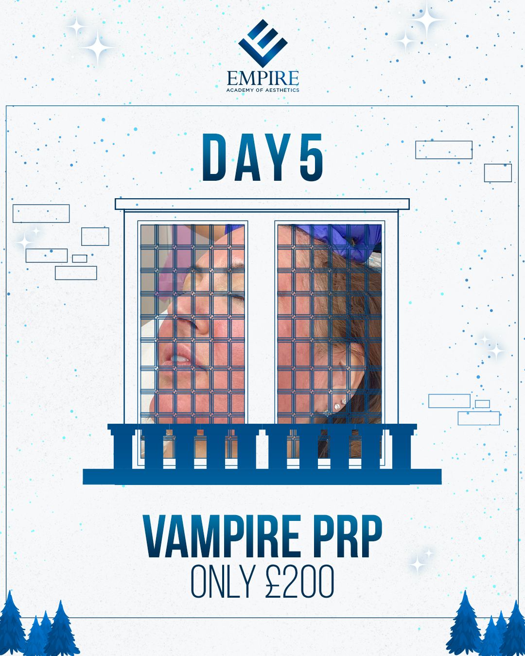 Vampire Facial Course (12 Days of Christmas - Day 5)