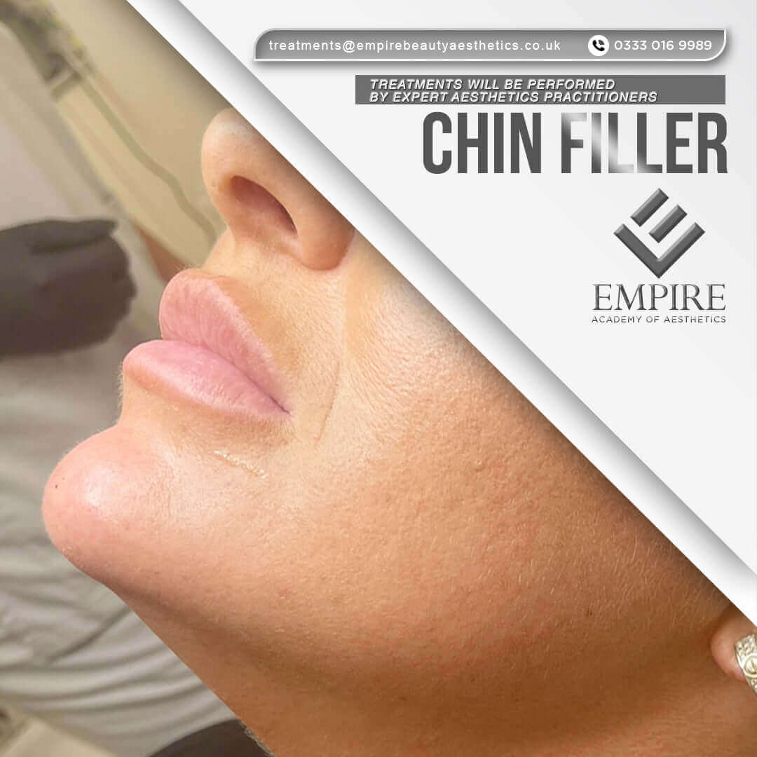 Discounted chin filler appointment as a model in Liverpool