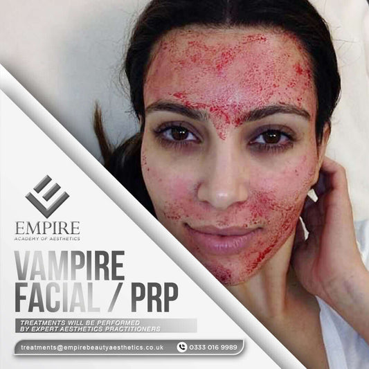 Vampire facial treatment as a model in our Liverpool clinic