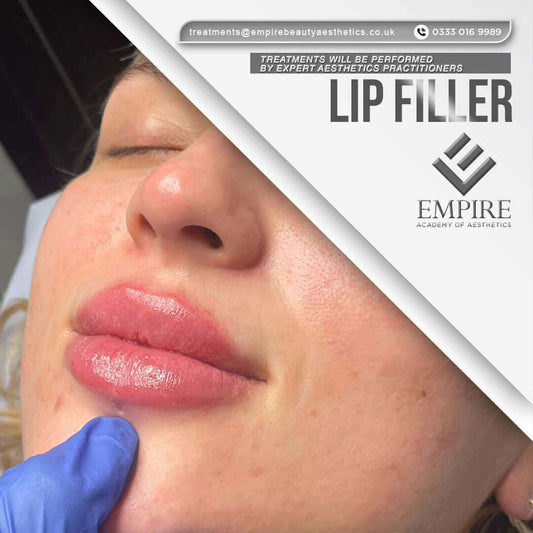 Lip Filler treatment as a model in our Warrington clinic
