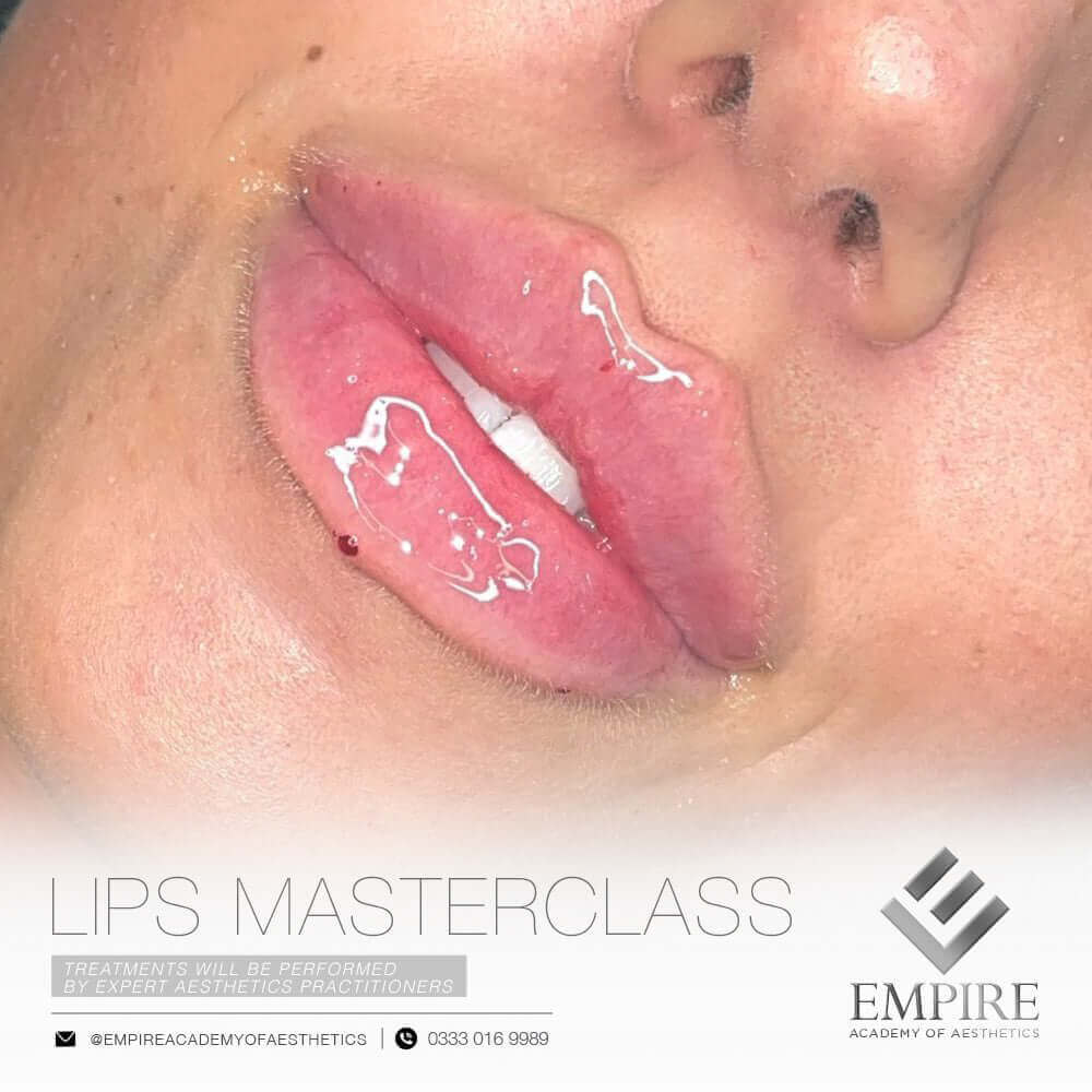 Lip Masterclass course. Course incudes Russian Lips